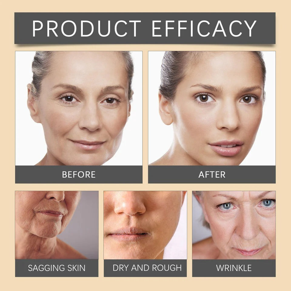 Bee Venom Botox Face Cream – Whitening, Anti-Aging & Deep Moisturizing Skincare for Bright, Smooth & Hydrated Skin