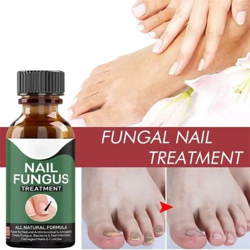 Fast Nail Fungus Treatment Serum – Nail Repair Essence for Finger